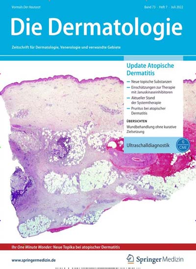 Der Hautarzt Titelbild der aktuellen Ausgabe Aktuelles Titelbild von Der Hautarzt. Entdecken Sie jetzt die aktuelle Ausgabe. Lesen Sie gerne Pflegezeitschriften und medizinische Fachzeitschriften? Dann empfehlen wir Ihnen Der Hautarzt als Abo oder Geschenkabo.