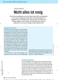 Titelbild der Ausgabe 4/2009 von Hautprobleme Nicht alles ist rosig. Zeitschriften als Abo oder epaper bei United Kiosk online kaufen.