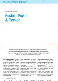 Titelbild der Ausgabe 4/2009 von Kinderkrankheiten Pusteln, Pickel & Flecken. Zeitschriften als Abo oder epaper bei United Kiosk online kaufen.