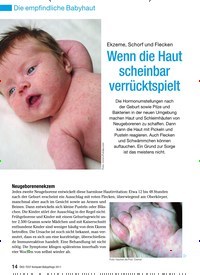 Titelbild der Ausgabe 4/2011 von Ekzeme, Schorf und Flecken Wenn die Haut scheinbar verrücktspielt. Zeitschriften als Abo oder epaper bei United Kiosk online kaufen.