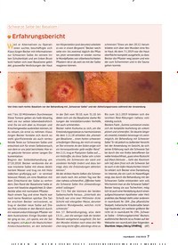 Titelbild der Ausgabe 218/2019 von Schwarze Salbe bei Basaliom: Erfahrungsbericht. Zeitschriften als Abo oder epaper bei United Kiosk online kaufen.