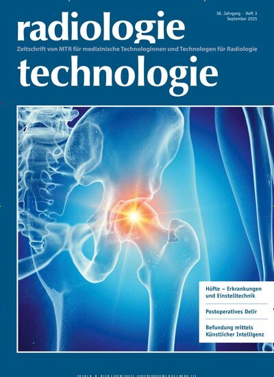 Titelbild der Ausgabe 3/2025 von radiologie technologie. Diese Zeitschrift und viele weitere Pflegezeitschriften und medizinische Fachzeitschriften als Abo oder epaper bei United Kiosk online kaufen.